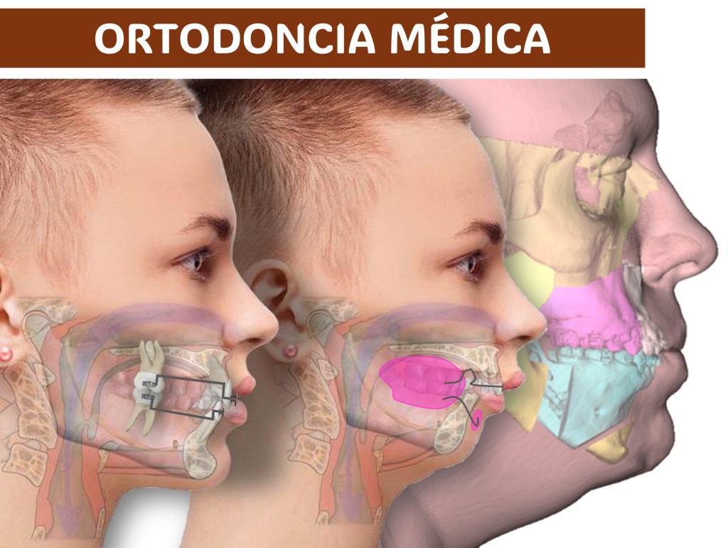 ORTODONCIA MÉDICA : ¿Por qué? ¿Para&nbsp;qué?